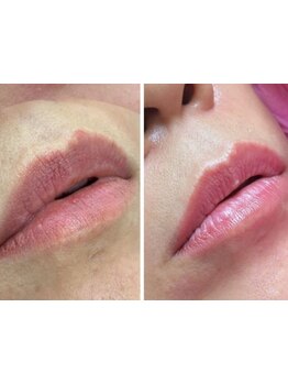 お肌をきれいにしたい