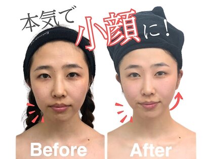 小顔フェイスラボ 磐田店(小顔FaceLabo.)の写真