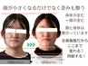 顔の左右差|顎の歪みに!歪みに特化したagoメソッドで骨から変わる【初回】