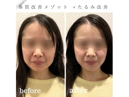 小顔コルギサロン シー(She)の写真