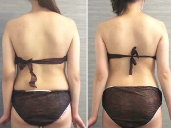 美容整体 ウェリナ 蟹江院/小顔矯正/骨盤矯正/痩身整体