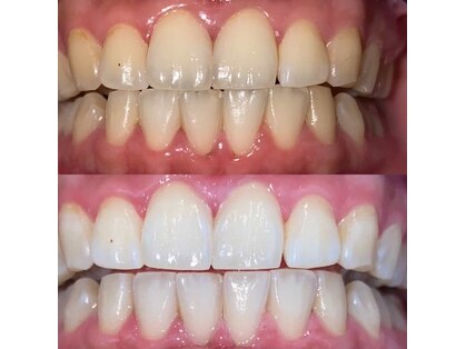 セルフホワイトニングサロン origin 大分王子店の写真