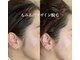 エステアンドヘアーサロン アルテ 札幌の写真