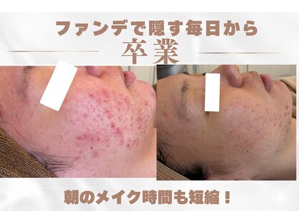 ポアレ(POARE)の写真