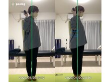 エヴォストレッチ(EVO STRETCH)/20代女性【パフォーマンス向上】