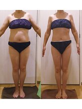 アユアランリンク 札幌中島公園店/F様：50代！美ボディ復活♪