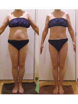 アユアランリンク 札幌中島公園店/F様：50代！美ボディ復活♪