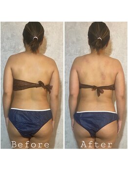 ラ ジェム(La gemme)/【ウルトランスフォーマー】