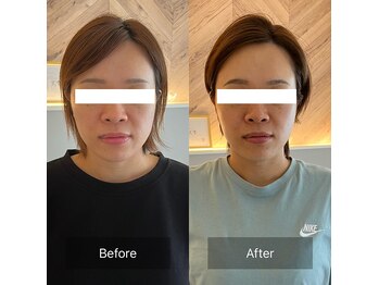 ララミビューティー(LARAmi beauty)