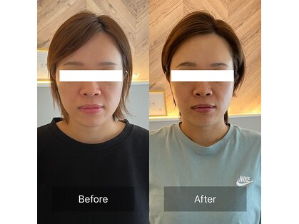 ララミビューティー(LARAmi beauty)の写真