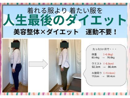 コレットの写真