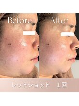 ステラティエ(Stellatier)