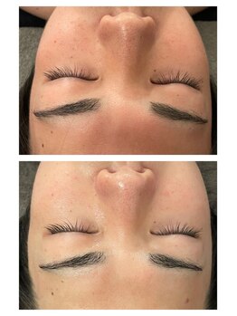 ルース(LUZ)/お肌の赤みにはメンズエステ