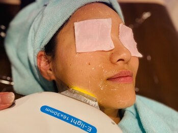 ハピエルルーム(HAPPYEL ROOM)/BYMACH 光フェイシャル