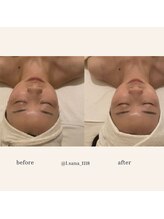 エルドットサナ(L.sana)/小顔矯正フェイシャル