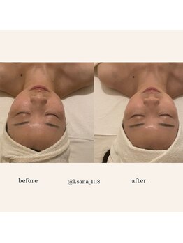 エルドットサナ(L.sana)/小顔矯正フェイシャル