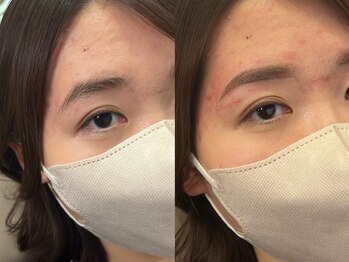 チルアンドアイ 千葉駅前店(Chill&Eye)/美眉スタイリング/BeforeAfter