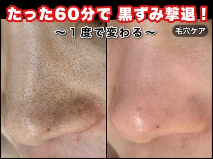 ビューティーグロウ(BEAUTY-GROW)の写真