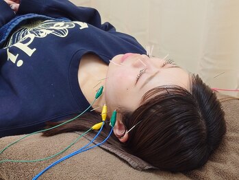 スカイブルー鍼灸接骨院/美容鍼