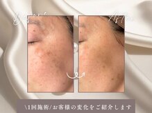 ハリーネ(HARINE)の雰囲気（素肌に自信！シャルムボーフェイシャルで内側から輝くお肌に♪）