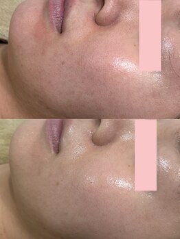 ビビィ(Bibiy)/クリスティーナ/アンストレス