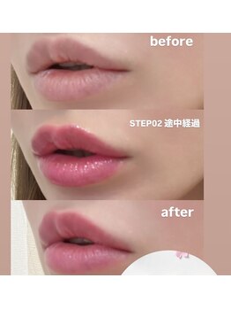 ビューティーツリー(Beauty Tree)/体内健康・ラドン浴!