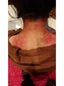 タイ古式マッサージ チェンマイ/カッサは女性に人気です(^^)