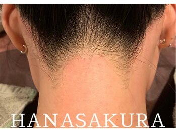 サロン ツムギ たまプラーザ店(SALON TSUMUGI)/うなじワックスで後ろ姿も美しく