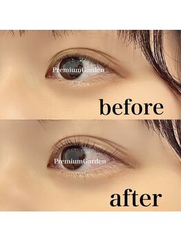 プレミアムガーデン(Premium Garden)/