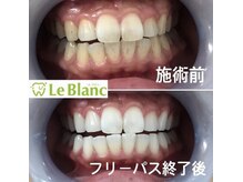 ルブラン 奈良店(Le Blanc)/学生さんも大歓迎！
