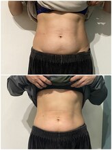 OBS/OBS痩身お腹集中～途中経過～