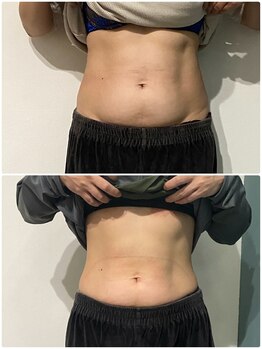 OBS/OBS痩身お腹集中～途中経過～