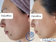 カロニア(CaLoNia)/憧れ韓国美人☆水光肌へ