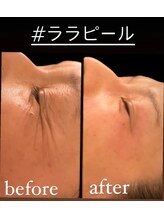 ジーニー(Genie)/ララピール始めました！