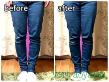 ヴェール 青山(vert)/骨盤矯正ビフォーアフター