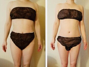 マナ(mana)/40代ダイエット/姿勢/お腹