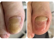 ロンディネ(Rondine)/トラブルネイル19