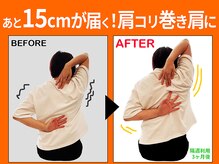 ストレチックス 綱島店/【実例：手組】隔週3ヵ月の変化