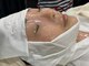 ルアナライフ(Luana Life)の写真/【VOSサロンケア】微細針による短期間肌質改善へ◎ダウンタイムなし/剥かない【グレイズソフトピール】も!