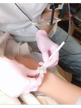 ビー ファクトリー(B FACTORY)/美容電気脱毛