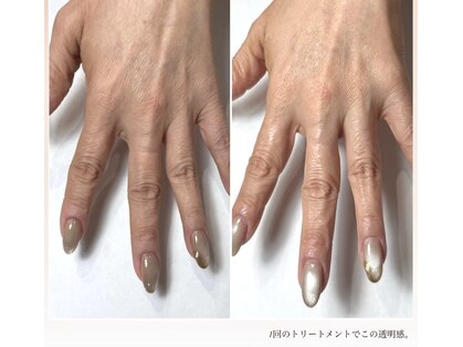 アメリー(Amary.)の写真