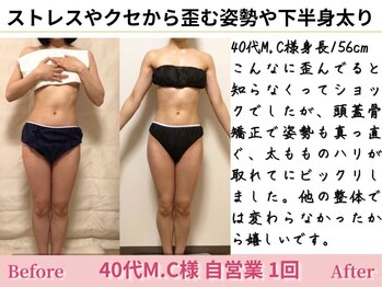 アメリイ 百合ヶ丘 新百合ヶ丘(Amerii)/【40代歪み】頭蓋骨矯正で歪みに