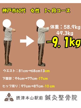 摂津本山駅前鍼灸整骨院/50代女性
