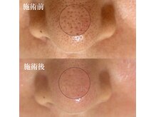 マニス(MANIS)の雰囲気（毛穴でお悩みの方は当店にお任せください☆）