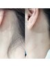 ★2ヶ月以内ご来店★ うなじ美人WAX