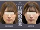 カロン(KALON)の写真