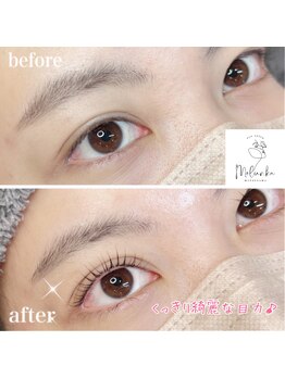 モルンカ 松山(Molunka)/