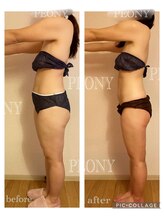 ピオニー(PEONY)/【痩身】サイズダウン 短期集中