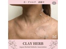 スリジエ ボーテ(cerisierBEAUTE)/魅せるデコルテ作りに☆