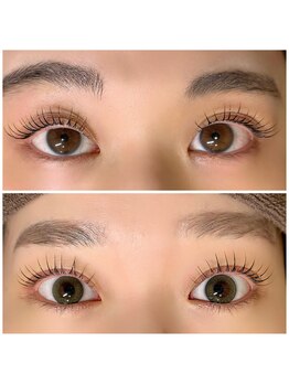 エル(L)/メーテル